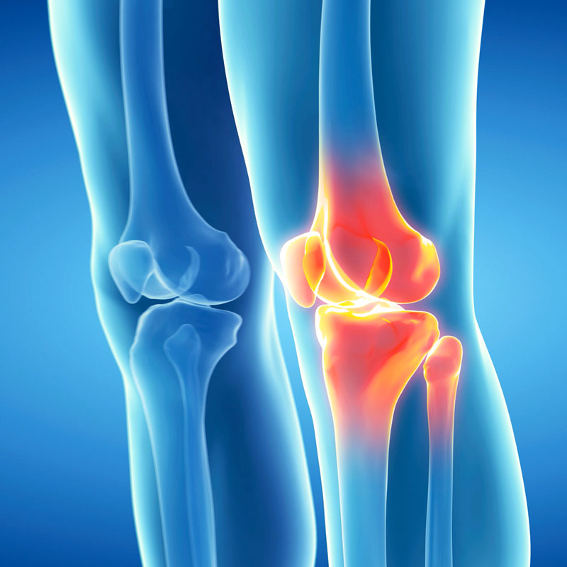 Orthopedic Knee Specialist